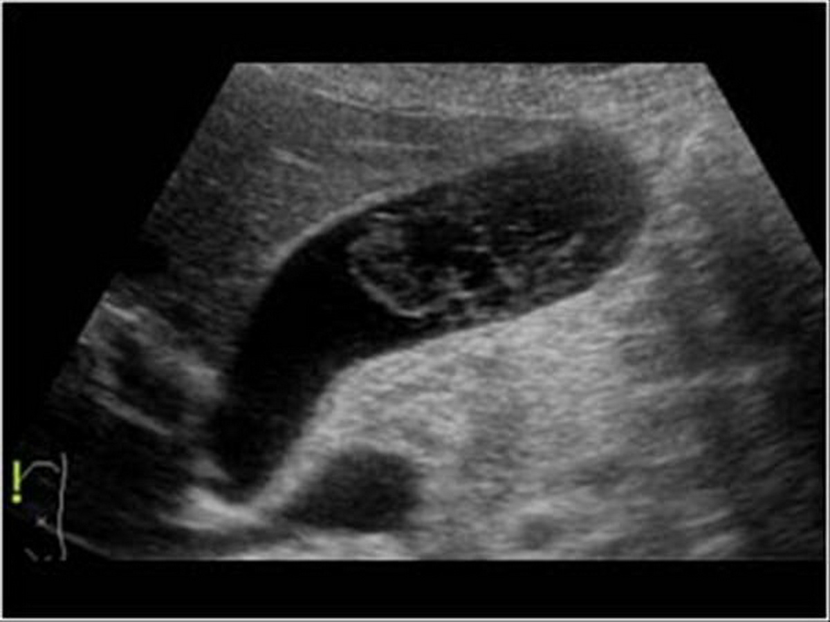 Abdomen and retroperitoneum sample